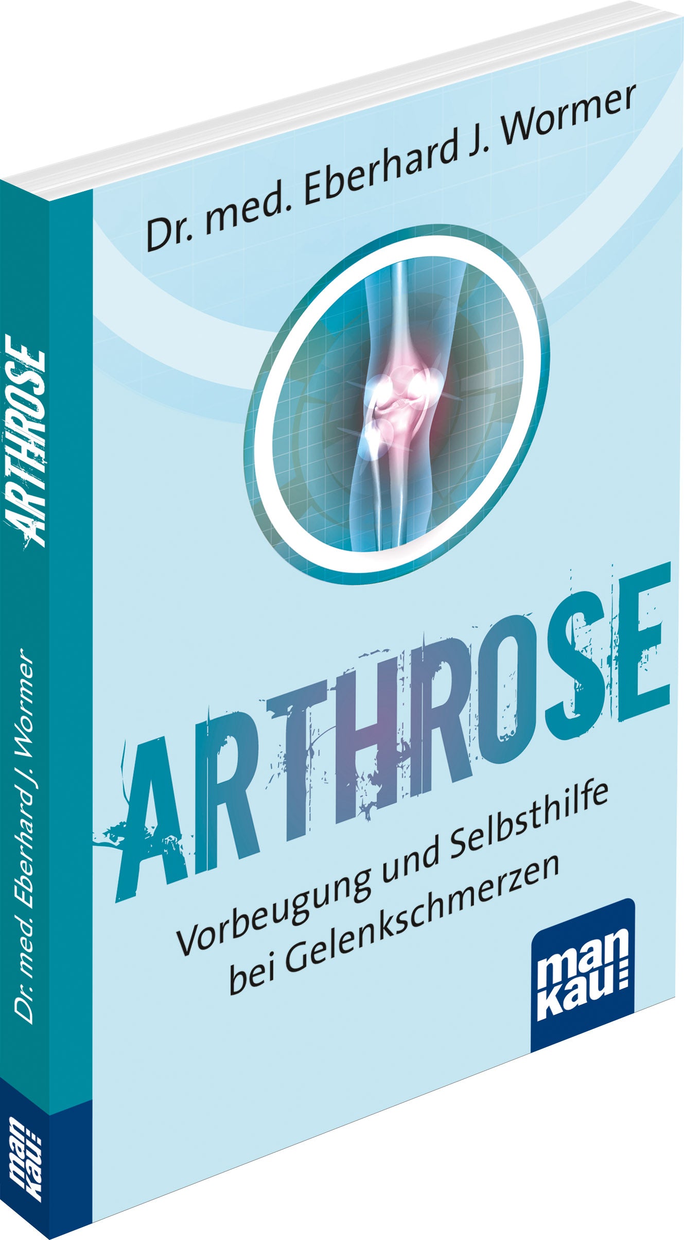 Arthrose_3d
