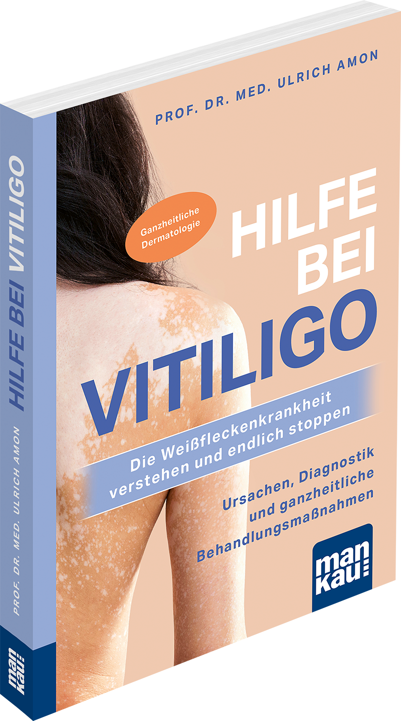 Hilfe bei Vitiligo